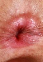 Asia Rivera Gaping outside a Bikini, Asia Rivera (asi010) ATK Exotics: Asia Rivera (Asia Rivera Gaping outside a Bikini)