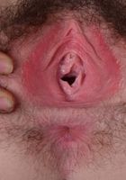 Emma has a beautiful pussy, with a ring of fur around it., Emma Evins (emm030) ATK Natural & Hairy: Emma Evins (Emma has a beautiful pussy, with a ring of fur around it.)