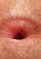 Lana Smalls gapes both holes, Lana Smalls (lan037) ATK Galleria: Lana Smalls (Lana Smalls gapes both holes)