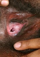 Miltie in black women, Miltie (mil020) ATK Exotics: Miltie (Miltie in black women)