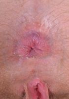 Nickey gapes her big lipped hairy pussy., Nickey Huntsman (nic093) ATK Petites: Nickey Huntsman (Nickey gapes her big lipped hairy pussy.)
