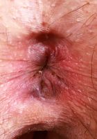 Riley Rose pinches nipples and tugs pubes, Riley Rose (ril021) ATK Natural & Hairy: Riley Rose (Riley Rose pinches nipples and tugs pubes)